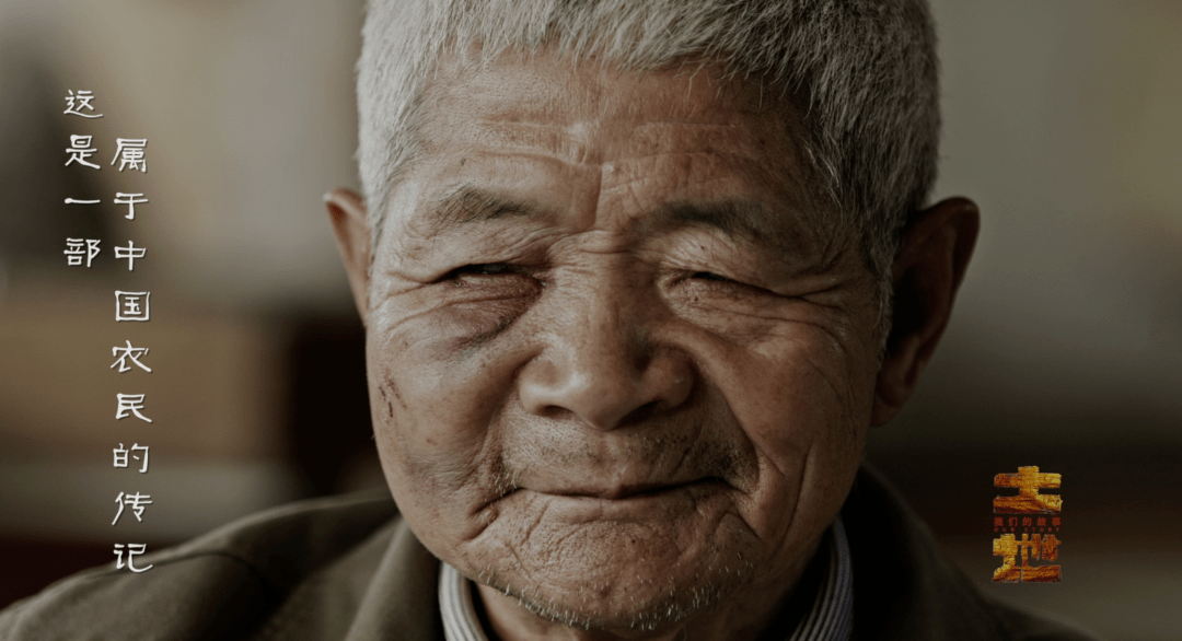 土耳其男子蝉联世界鼻子最大的人，一个非凡的记录与背后的故事土耳其鼻子整形
